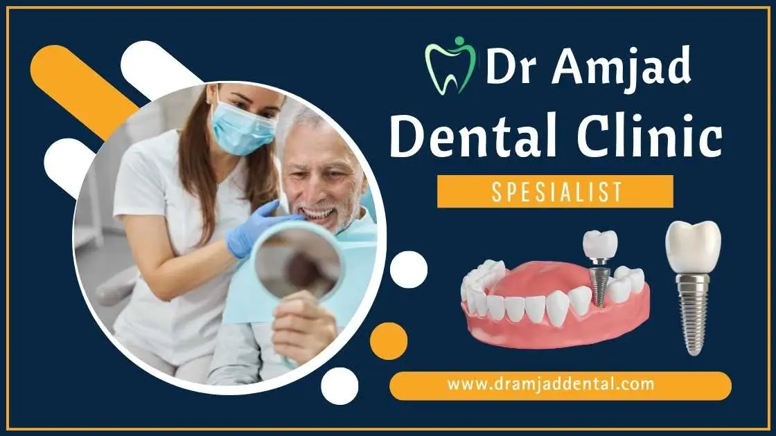 The Benefits of Dental Implants: A Permanent Solution for Missing Teeth